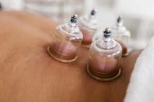 cupping therapy massage